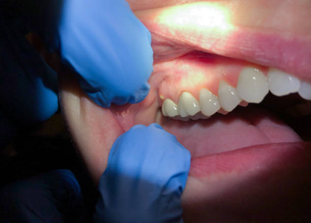 Best After-Hours Emergency Dentist in Honaker, VA