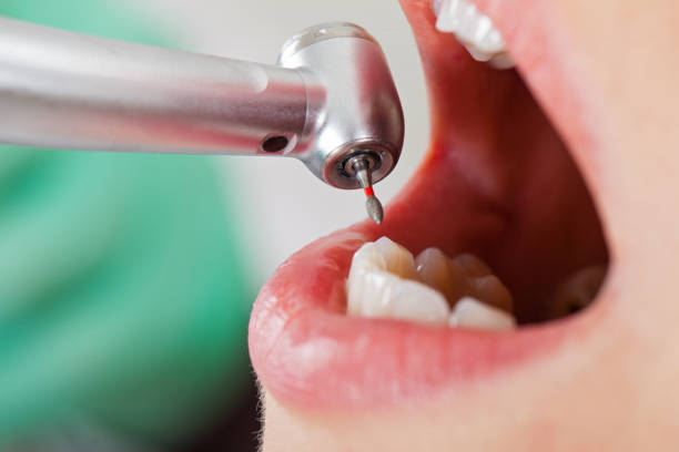 Best Urgent Dental Care in Honaker, VA